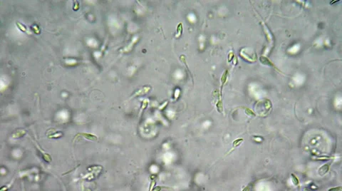 Sperm under microscope Video stock 33661265