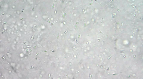 Sperm under microscope Video stock 33661345