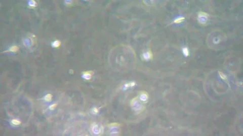 Sperm under microscope Video stock 33661367