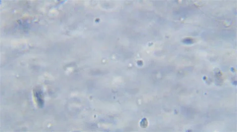 Sperm under microscope Stock Footage 45309157