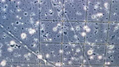 Sperm under microscope Stock Footage 147949398