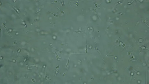 sperm microscope 400x