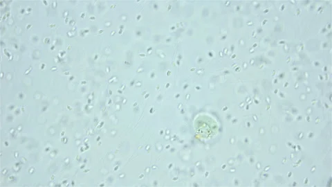 Sperm of Worm Polychaeta Nereis virens  under microscope, Nereididae Stock Footage 249796357