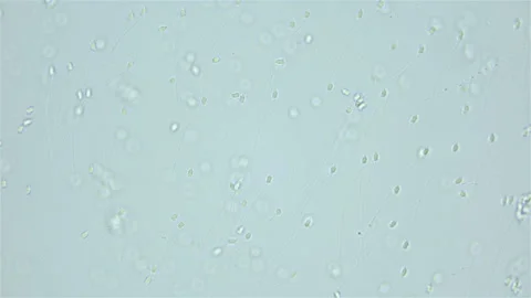 Sperm of Worm Polychaeta Nereis virens under microscope, Nereididae Stock Footage 249997097