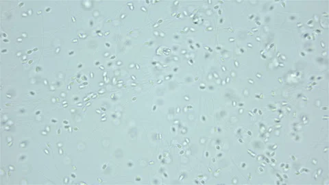 Sperm of Worm Polychaeta Nereis virens under microscope, Nereididae Stock Footage 249997290