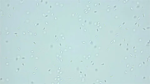 Sperm of Worm Polychaeta Nereis virens under microscope, Nereididae Stock Footage 249997437