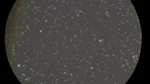 Spermatozoa cells Stock Footage 159901763