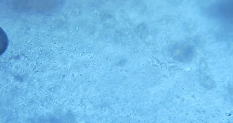 Spermatozoa under the microscope Stock Footage 88427900