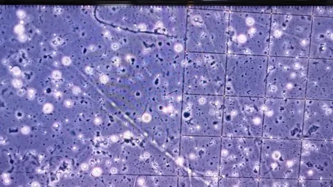 Spermatozoons under microscope Stock Footage 147949403