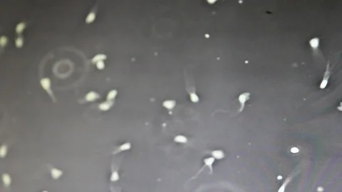 Sperms Moving In A Microscopic View Vidéo 125702664