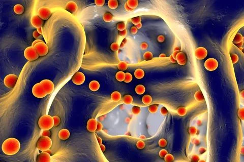 Spherical bacteria inside bone tissue Illustrazione stock