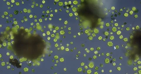 Spherical colonial algae Pandorina swimming 100x. Dark background Stock Footage 199860306