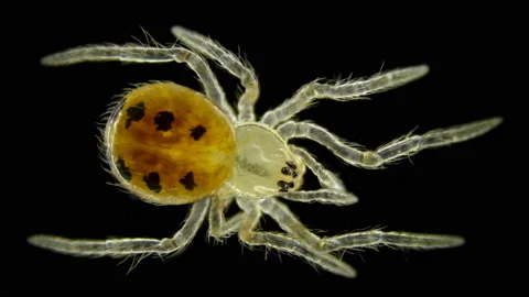 Spider Araneae type Arthropoda, under a microscope Stock Footage 105612584