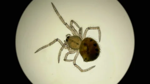 Spider Araneae type Arthropoda, under a microscope Stock Footage 105615462