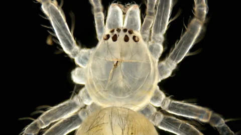 Spider under a microscope, Arachnida class, Arthropoda squad Stock Footage 112440854