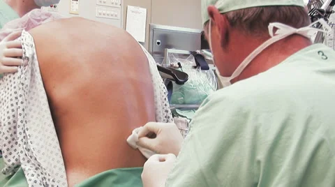 Spinal Anesthesia close up Stock-Footage 67279810