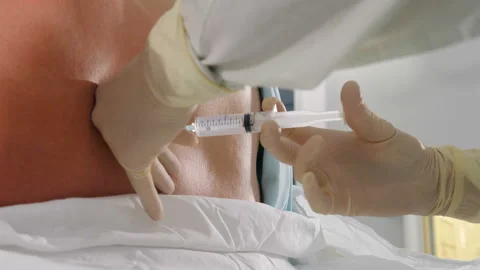 Spinal anesthesia injection, epidural anesthesia or nerve block Stock Footage 158415321