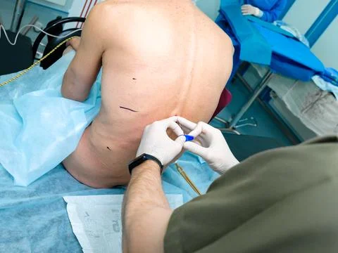 Spinal anesthesia in preparation for surgery. Stock Photos