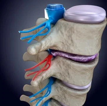 Spinal cord under pressure of bulging disc Stock Illustration