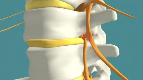 Spinal disc herniation, back pain, 3d animation Stock Footage 149478561