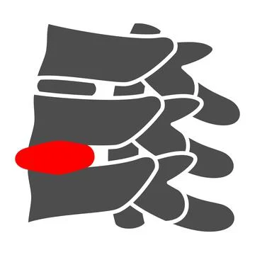 Spinal hernia solid icon, Human diseases concept, Back Pain sign on white Stockillustratie