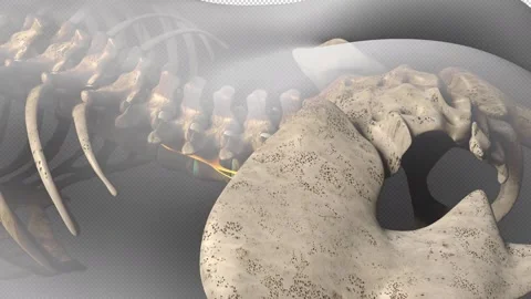 Spinal Nerve Inflammation Stock Footage 154886575