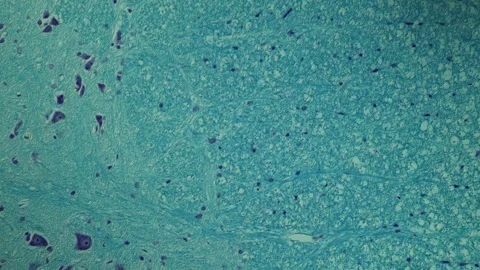 Spinal nerves cells under the microscope Stock Footage 343132113