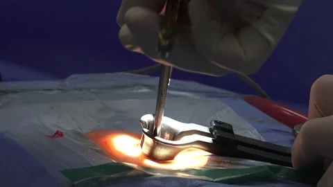 Spinal or Spine Surgery close up shot Stock Footage 239756604