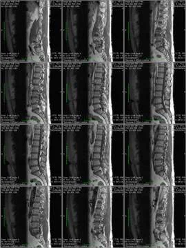 Spine 1 Stock Photos