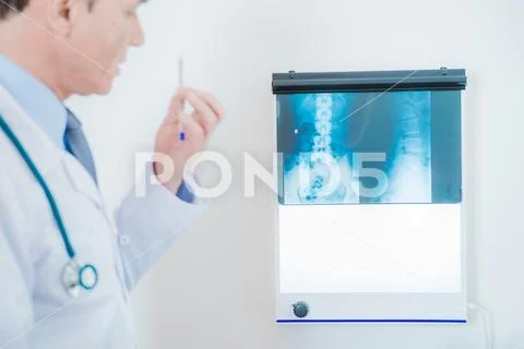 Spine Damage X Ray Scan. Caucasian Doctor Review Xray Imagery. Stock Photos