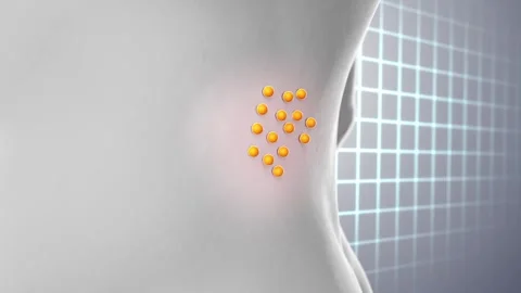 Spine focus trigger point and have particle relieve painful  Video stock 248050500