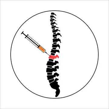 Spine joint injection Stock Illustration
