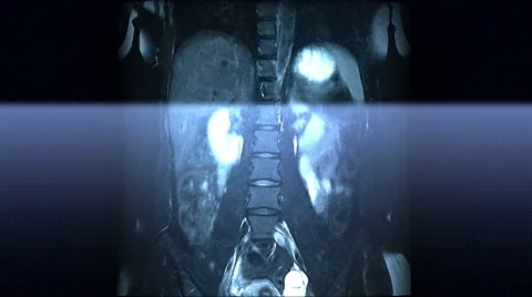 Spine MRI Scan Stock-Footage 63209102