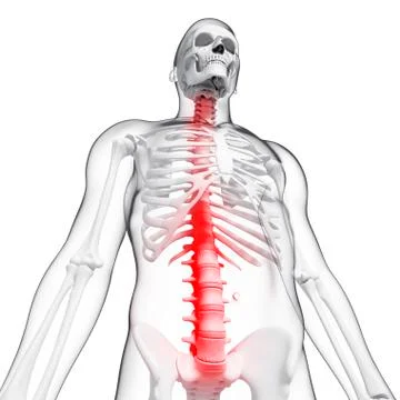 Spine pain, artwork Stock Illustration