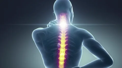 Spine pain in cervical region - backbone concept Stock Footage