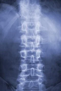 Spine on x-ray Stock Illustration
