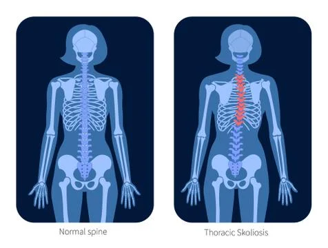 Spine X ray Stock Illustration