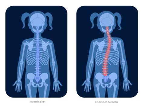 Spine X ray Stock Illustration
