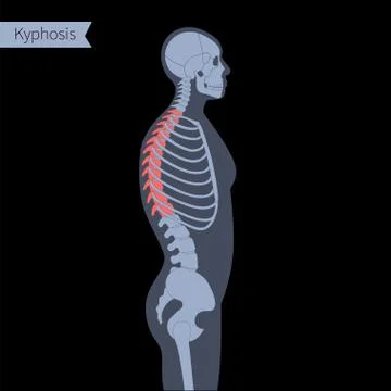 Spine X ray Stock Illustration