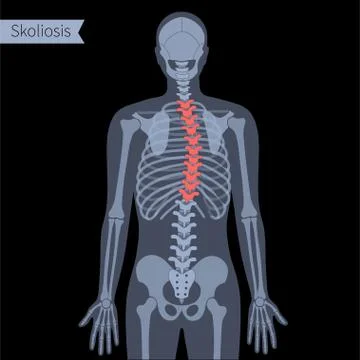 Spine X ray Stock Illustration