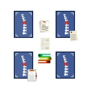 Spine on x-ray image. Bones of back. Poor posture. Health care. White vertebr Illustrazione stock