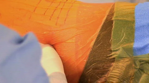 Spine1 스톡 동영상 151304