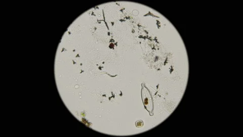 spiral bacteria under microscope