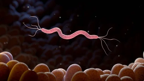 Spirillum bacteria in the stomach Vidéo 226973554