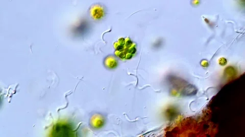 Spirochete bacteria and green algae under microscope, 400x Video stock 317790071