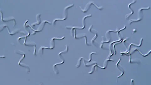 Spirochetes bacteria- Microscope view 400x 動画素材 317956347