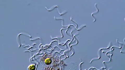 Spirochetes bacteria under DIC microscope, 400x magnification Stock Footage 317956428