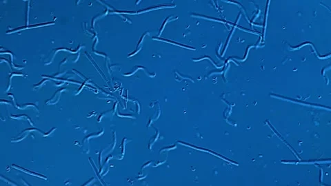 Spirochetes bacteria under microscope view 库存影片 306581292
