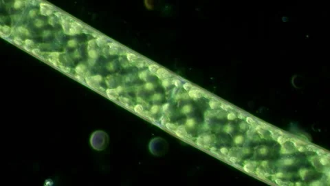 Spirogyra Algae at 20x Under Darkfield Microscopy Stock Footage 335474979