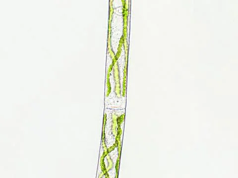 Spirogyra sp. algae under microscopic view, Chlorophyta Stock Photos